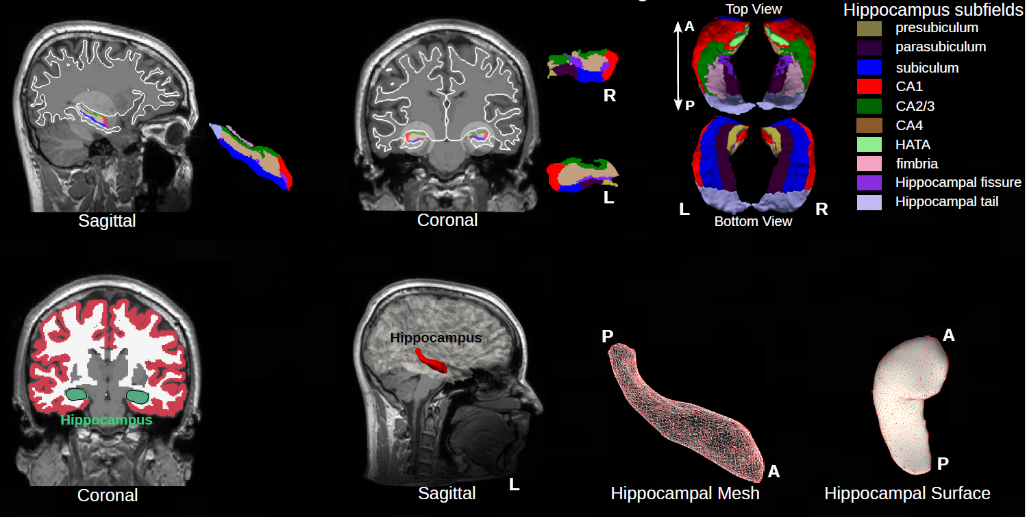 Hippocampus subfields and segmentation visual for visual oddball P3 preprint