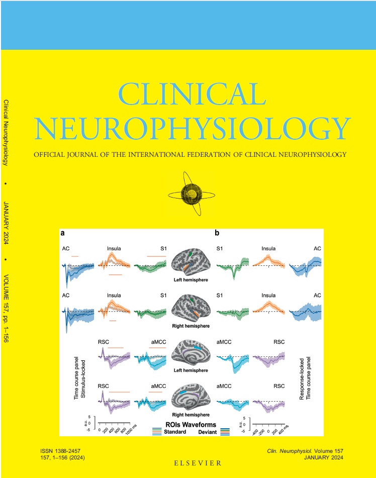 Clinical Neurophysiology journal cover featuring Diptyajit Das paper image